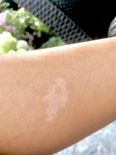 I have an upvote shaped birthmark on my leg : r/mildlyinteresting