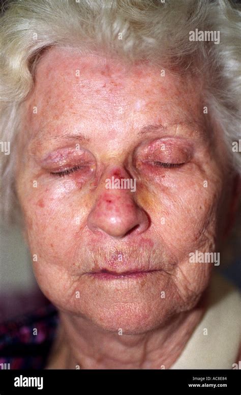 older woman with bruised face after fall in parking lot 1551 Stock Photo - Alamy