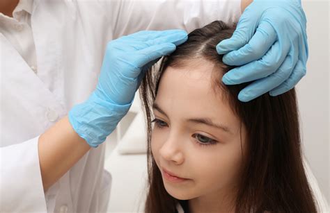 Say Goodbye to Head Lice: Easy and Effective Treatment Options - Advanced Dermatology Care