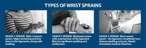 How to Treat a Sprained Wrist – Best Remedies to Apply