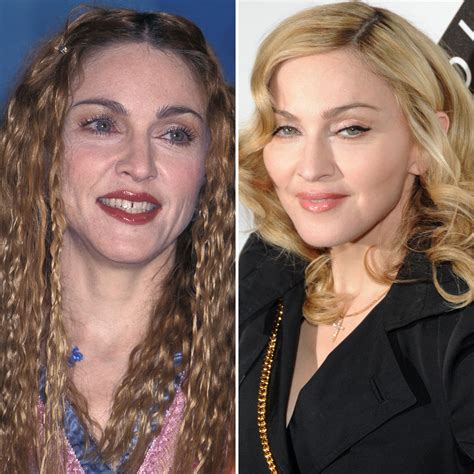 Madonna Face Lift