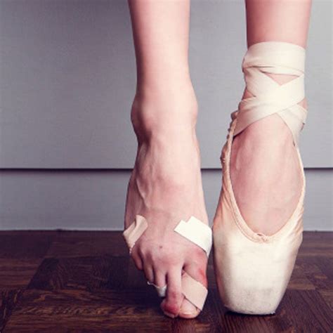 Footlab+ | Ingrown Toenails in Dancers