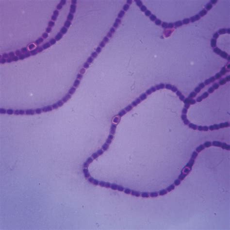 Nostoc, w.m. Microscope Slide | Carolina Biological Supply