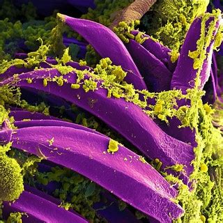 Yersinia pestis Bacteria | Scanning electron micrograph of Y… | Flickr