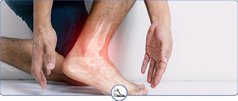 Ankle Ganglion Cyst Treatment Near Me | Convenient Locations