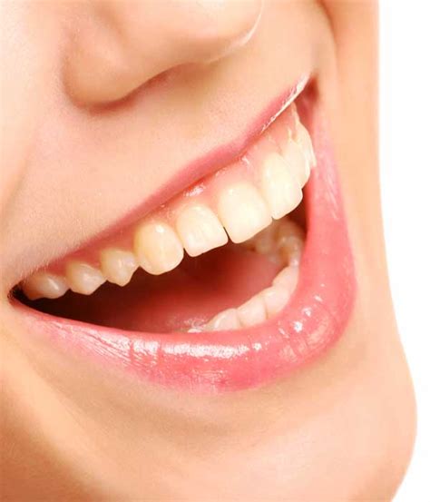 Enhance Your Smile with Treatment for Gapped Teeth | Lake Mary Dentistry