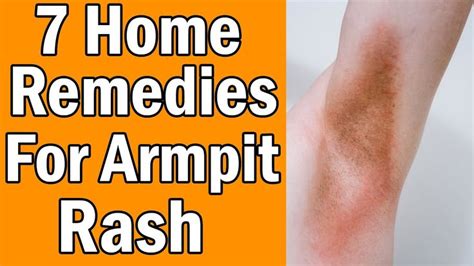 7 Home Remedies For Armpit Rash in 2020 | Armpit rash, Home remedies, Rashes remedies