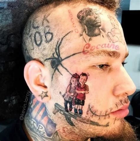 Rapper Stitches Gets a Brutal Face Tattoo