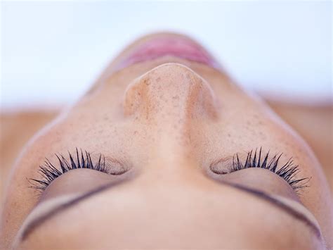 Double Eyelashes (Distichiasis): Causes and Treatment