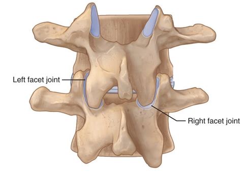 Facet Joint Injuries - My Family Physio