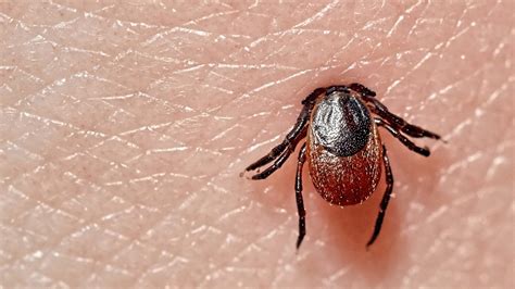 How To Remove a Tick (and Other Tick Tips) - First For Women