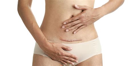 4 Less Invasive Alternatives to the Traditional Tummy Tuck