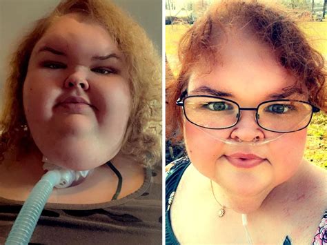 1000-Lb Sisters Star Tammy Slaton Shows Dramatic Weight Loss