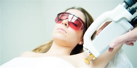 The Pros and Cons of Laser Hair Removal | SELF