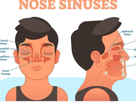 Sinus Rinse Recipe | Dandk Organizer