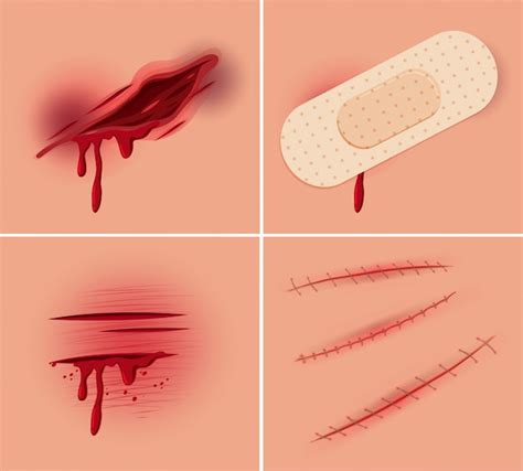 Wound Images | Free Vectors, Stock Photos & PSD