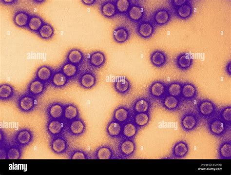 Electron micrograph of equine adenovirus Stock Photo - Alamy