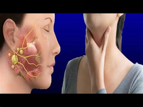 Lump Under The Chin: Causes And Symptoms - YouTube