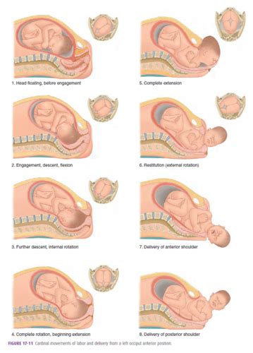 Cardinal Movements & Stages of Labor Flashcards | Quizlet