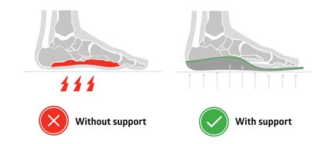 Cure Plantar Fasciitis with Custom Moldable Orthopedic Insoles - SOLE