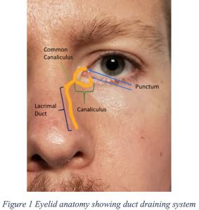 Preventing Scarface: Pearls for Complicated Facial Lacerations – Eyelid Lacerations | LaptrinhX ...