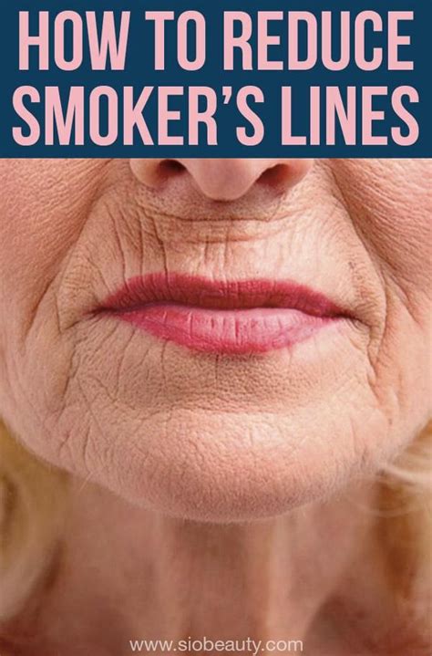 How to get rid of Smoker’s Lines: If you're seeing signs of those pesky ...