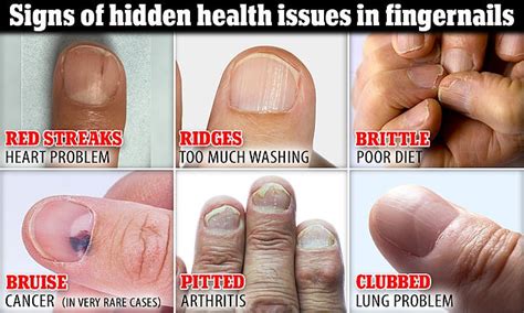 Healthy Fingernails