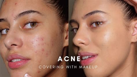 HOW TO: COVER ACNE WITH MAKEUP (BASE ROUTINE) - YouTube