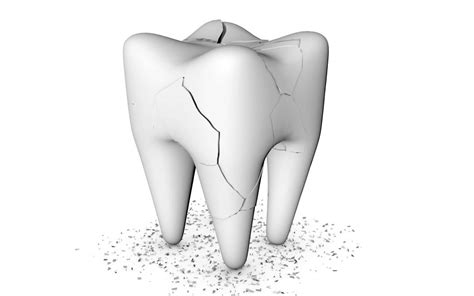 What to do with cracked tooth under the crown of root canal