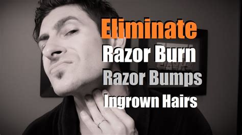 How To Eliminate Razor Burn, Bumps and Ingrown Hairs | Razor Burn Prevention - YouTube