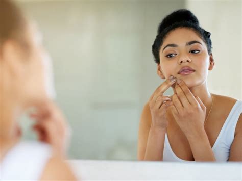 Which acne home remedies actually work? - National | Globalnews.ca