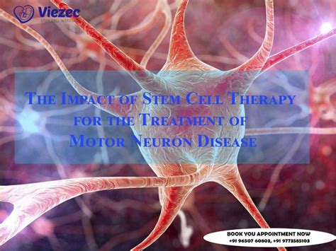 Motor Neuron Disease Treatment through Stem Cell Therapy