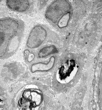 Electron microscopy (Uranyl Acetate-Lead Citrate Stain, 4400x). A.... | Download Scientific Diagram