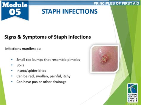 13-staph-infections – National Center for Sports Safety