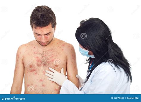 Doctor Examine Man Skin Rash Stock Image - Image of fever, contagious: 17275481