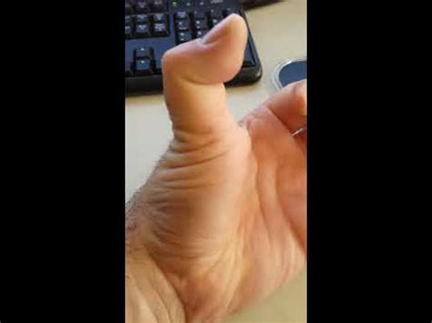 Double jointed thumb - YouTube