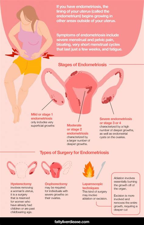 Endometriosis Surgery and How to Support Recovery - Fatty Liver Disease