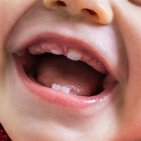 Common Questions About Baby Teeth: Answered - Ellicott Mills Dental