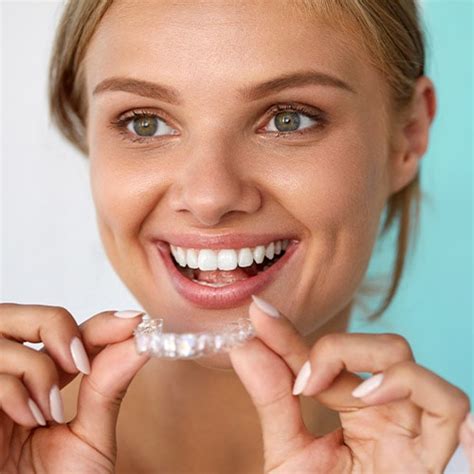 What Are Spark Clear Aligners? - Guidry & Horaist Orthodontics