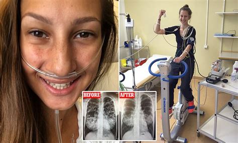 Cystic fibrosis sufferer had a DOUBLE lung transplant aged 22 | Daily ...