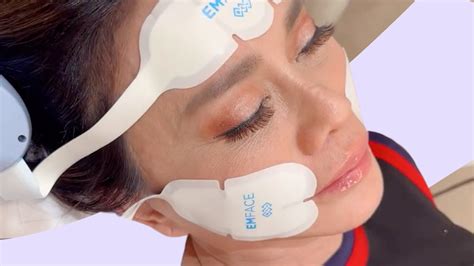 EmFace: Is It The Needle-Free Alternative To Botox? Everything You Need To Know | Glamour UK