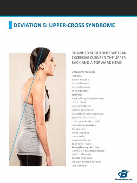 upper-cross syndrome - exercises and stretches to correct | Upper cross syndrome exercises ...