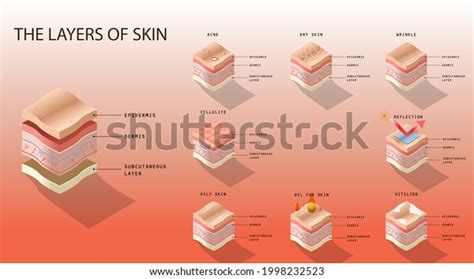 Educational Lessons About Layers Skin Humans: เวกเตอร์สต็อก (ปลอดค่าลิขสิทธิ์) 1998232523 ...