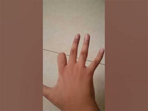 missing finger - YouTube