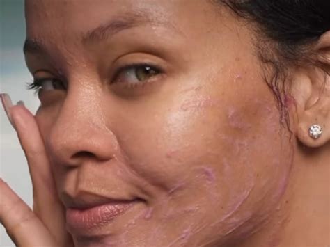 Rihanna Just Showed Off Her Natural Skin In Makeup-Free Video