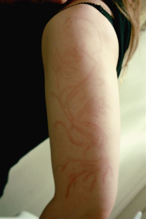 Scarification - 2 Months After by FindChaos on DeviantArt