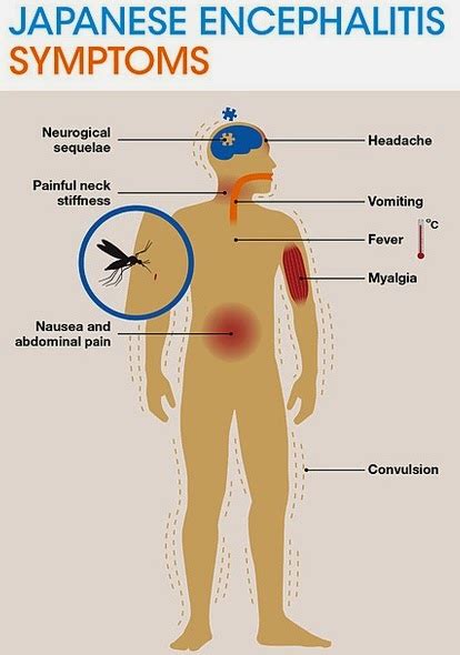 Japanese Encephalitis: Causes, Symptoms and Treatment | TechGape