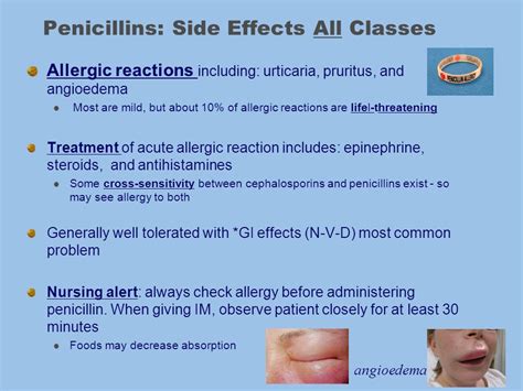 Penicillins: Side Effects - Antibiotic Drugs - AntiinfectiveMeds.com