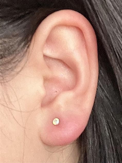 Help!!! Swollen lobe piercing : r/piercing