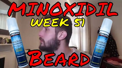 Minoxidil Beard Growth Results | Week 51 | Minoxidil 5% for Beard Growth | #Facialfuzzfridays ...